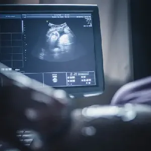 USG TVS Early pregnancy ultrasound / dating sonography scan